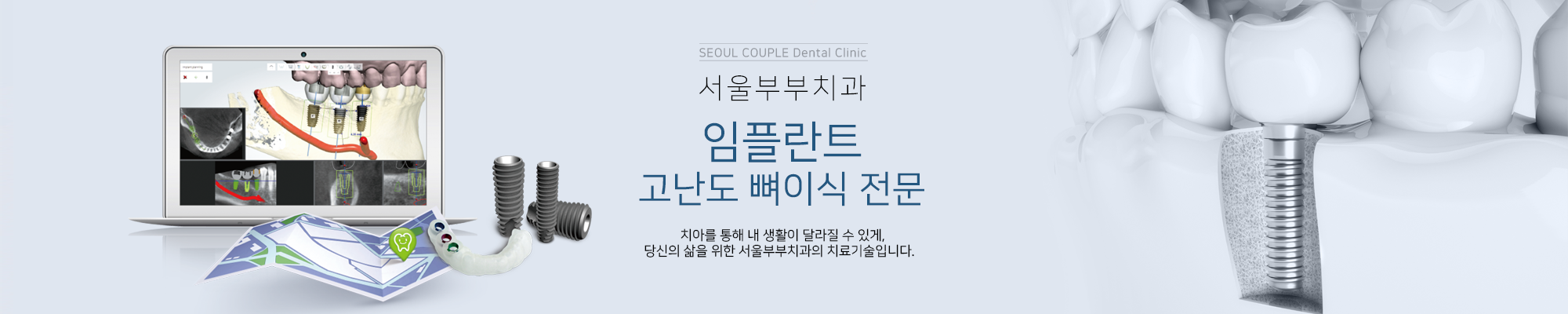 고난도 뼈이식 전문